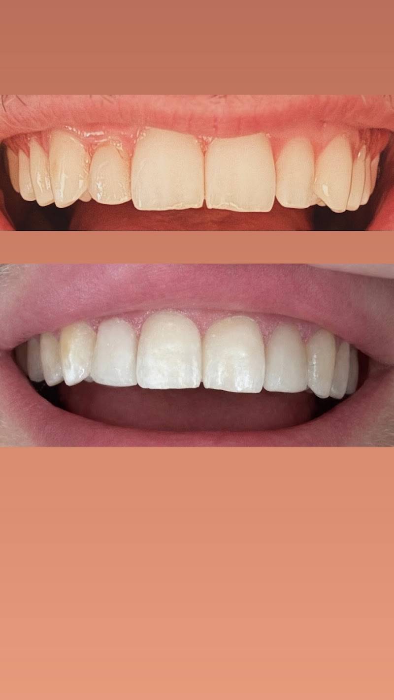 Hermitage Cosmetic and Implant Dentistry